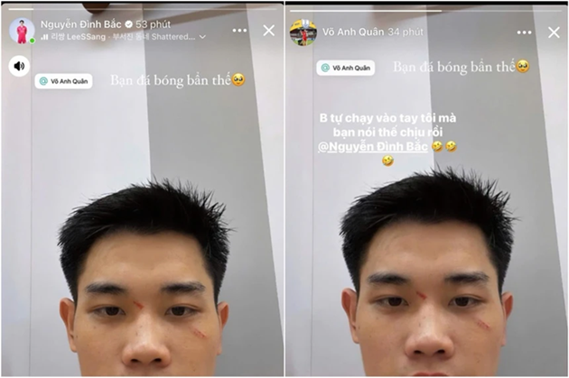 Đình Bắc đăng ảnh tố “chơi bẩn”, Anh Quân phản pháo