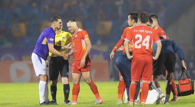 Trọng Hoàng suýt đứt tai sau pha va chạm mạnh với Hoàng Hên